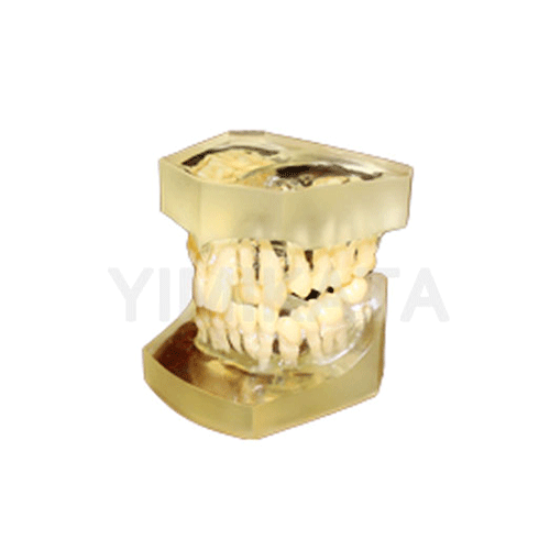 Modelo de enseñanza, Consumibles dentales, material dental, clinica dental, dent